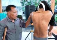Trauma Bertumpuk Luka, Seorang Pemuda Mengaku Jadi Korban Penganiayaan Anggota Polres Tuban